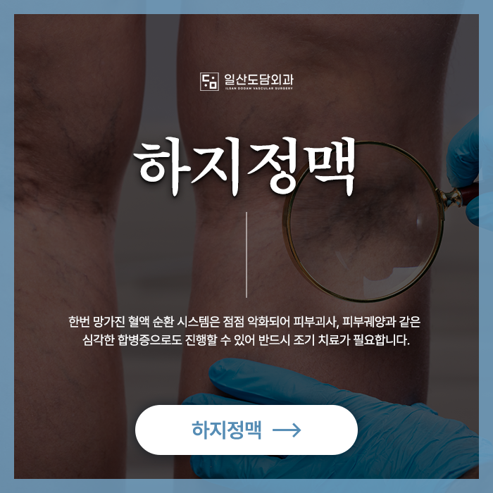 일산 하지정맥류 수술 치료 도담외과
